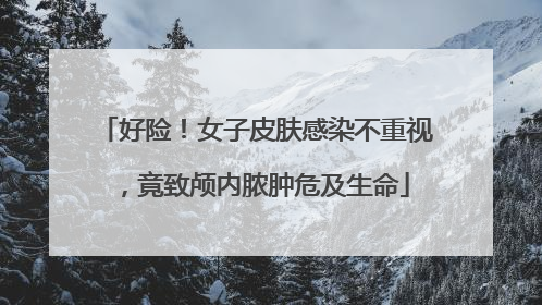 好险！女子皮肤感染不重视，竟致颅内脓肿危及生命
