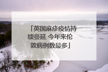 英国麻疹疫情持续蔓延 今年来伦敦病例数最多
